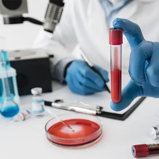 Tegretol (Carbamazepine)